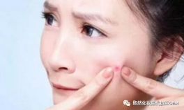 越南小姐姐去粉刺美容,探索天然护肤秘籍